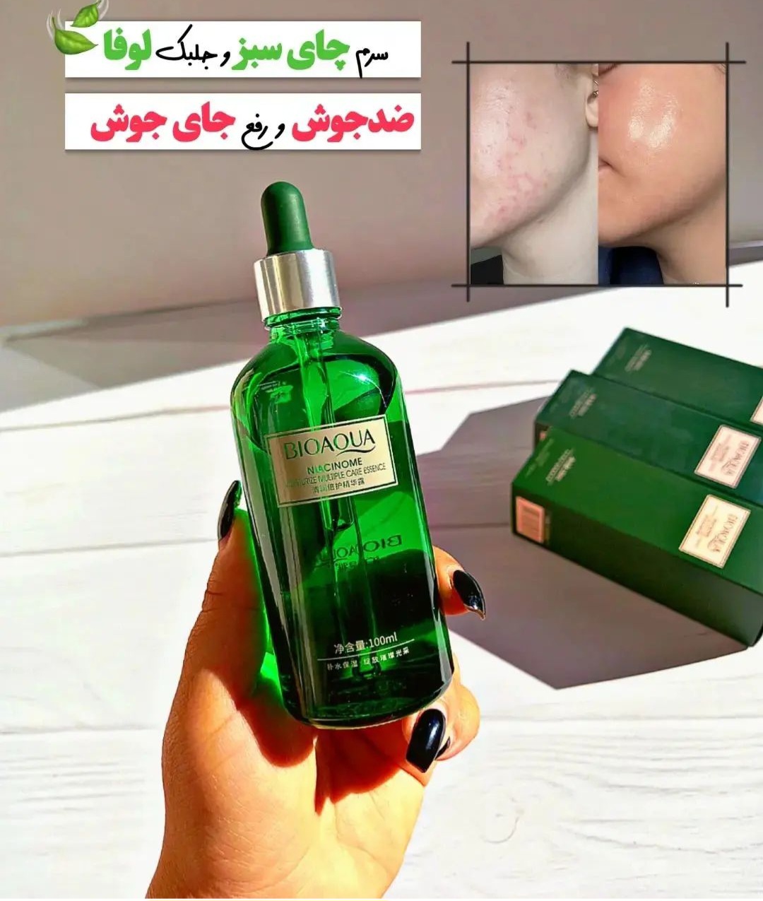 سرم ضدجوش چای سبز بیواکوا